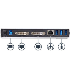 StarTech.com Dual-Monitor USB 3.0 Docking Station with DVI and Vertical Stand